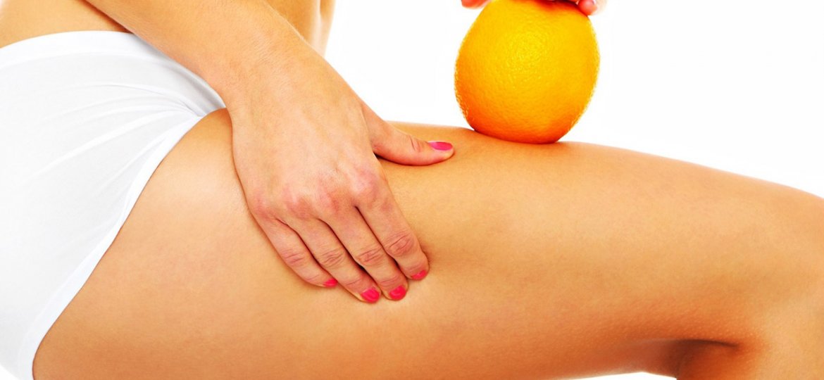 Cellulite Removal Surgery